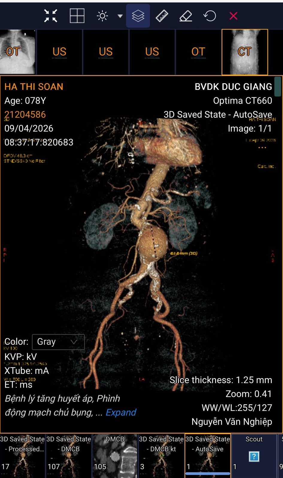 /images/companies/benhvienducgiang/images/2026/tháng 4/671634479_985395233826392_1128856500499091935_n.jpg